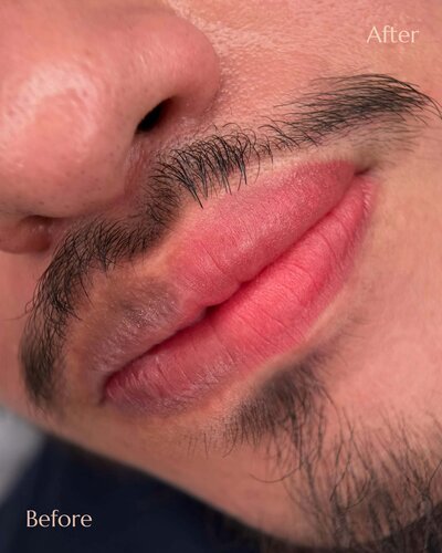 Male Dark Lips color correction