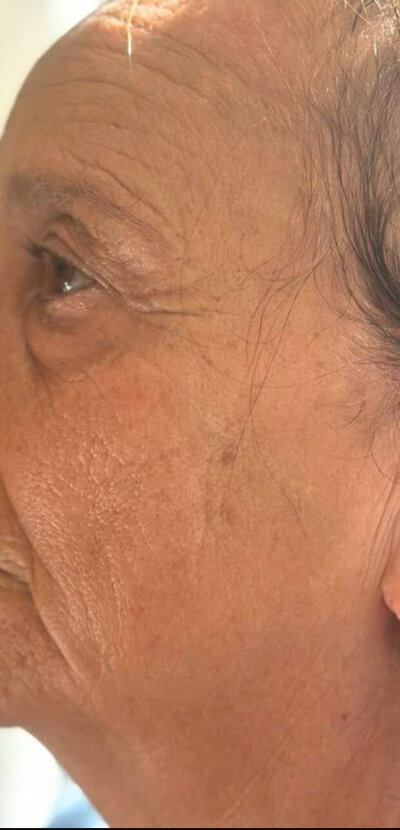 soins hydraskin peau femme