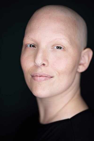 woman with a bold hair looking straight to the camera