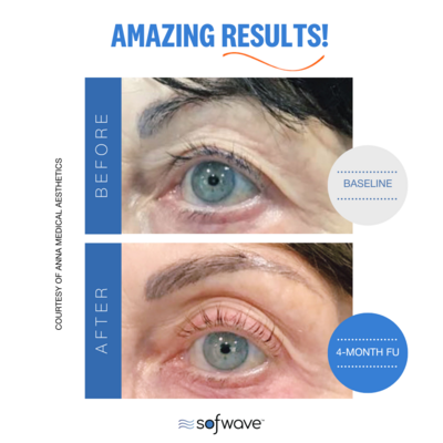 Set-31-Eyebrow