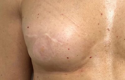 avant après salon esthétique trait delicat Montlucon