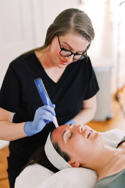 Microneedling Treatment for Acne Scaring