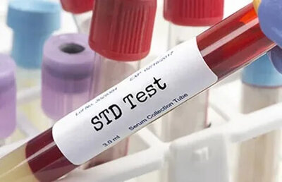 Sexually Transmitted Disease Testing