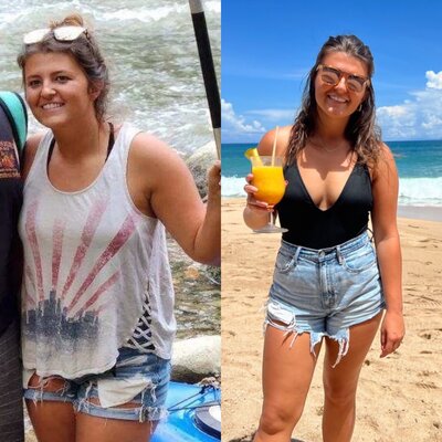 Before and afters of semaglutide results in ohio