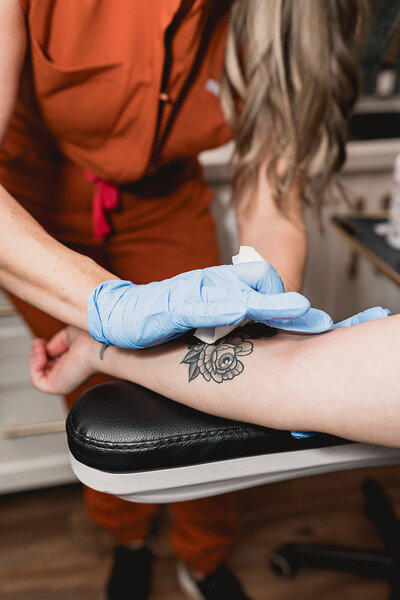 PRP vampire facial micro-needling