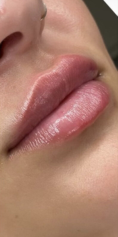 LipsAfter1