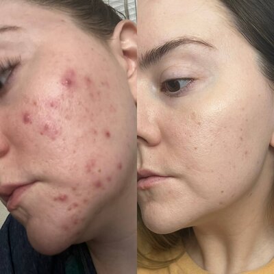 Bailey Skin Issue