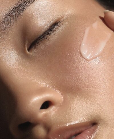 Perfect derma peel, acne peel, chemical peel in barrington IL. Peels help with pigmentation, acne, scarring and more.
