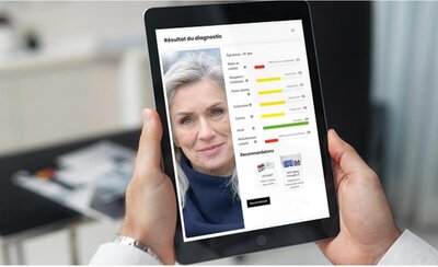 photo d'un diagnostic de peau avec ia check