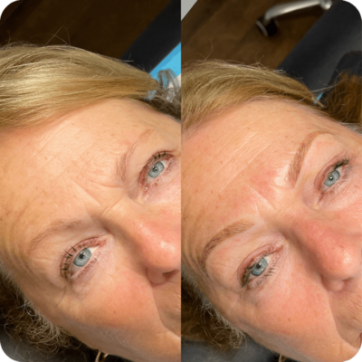Results from powder eyebrow treatment--before and after at Refresh Aesthetics