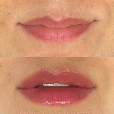 Before and After of Full Lip COlor Service