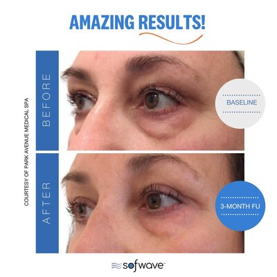 Set-41-Eyebrows