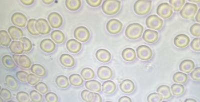 Levend bloed analyse 