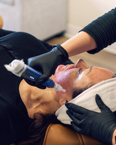 Botox Membership in Vancouver Wa