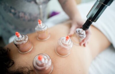 cupping therapy in st. petersburg