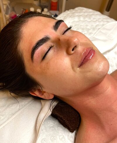 Skincare Client Result 1