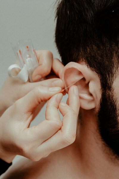 Acupuncturist inserts needle to male patient's ear