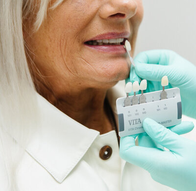 Prosthodontist determining the best color for veeners for a naturally white smile