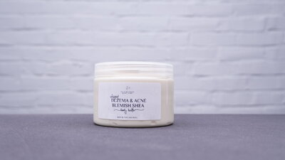 Eczema & Acne Blemish Body Butter | Tia's Blessed Body Care