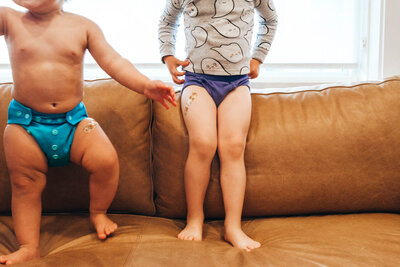 two children on the couch with bandaids on their legs