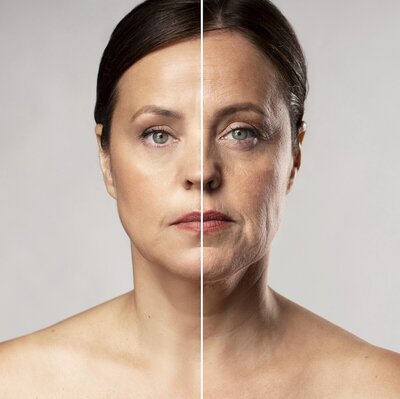 woman before and after receiving skin care treatment