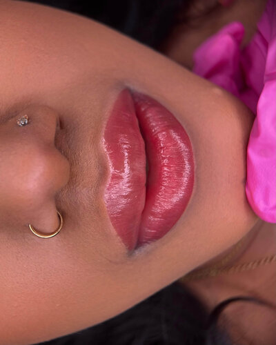 Lip Neutralization New York