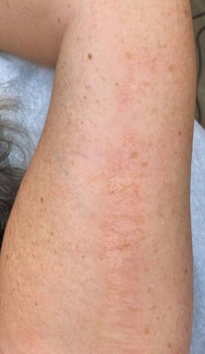 avant après salon esthétique trait delicat Montlucon