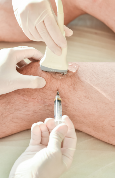 Premium Varicose Vein Stoking - Unimed