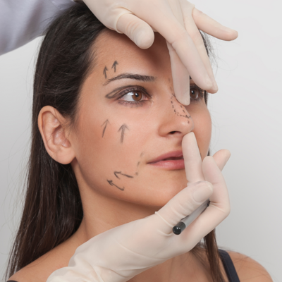 Image of woman getting drawings on face for surgery procedure