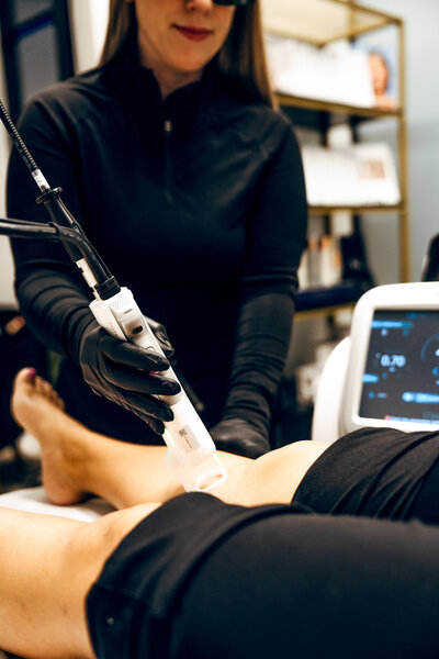 Provider targeting spider veins with precision laser tool during angioma removal session