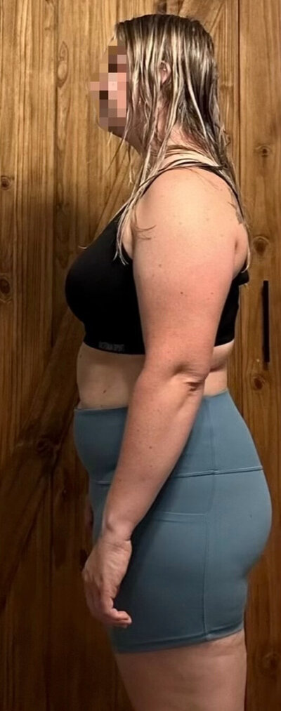 Before Side