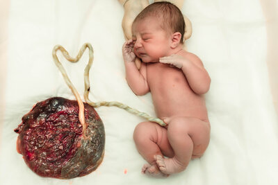 Newborn baby still attached to their placenta by their umbilical cord