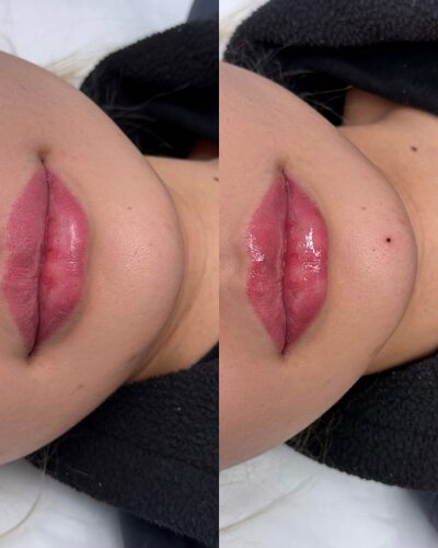 Beauty  mark tattoo in NYC