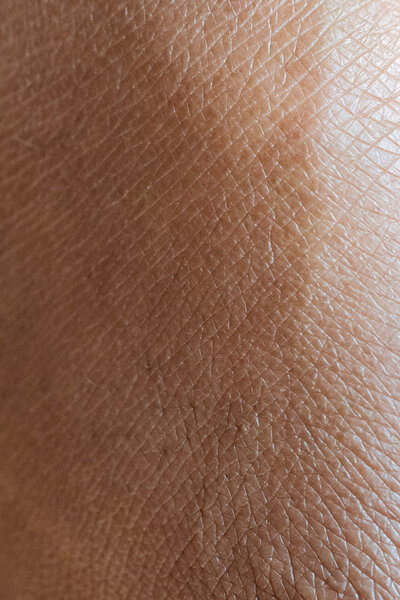 close up image of dark skin
