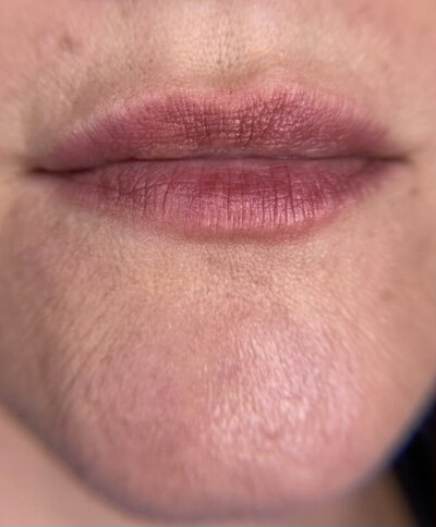 LipsBefore14