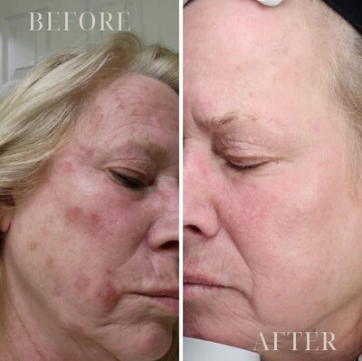 Ardent Transformation Journey before and after