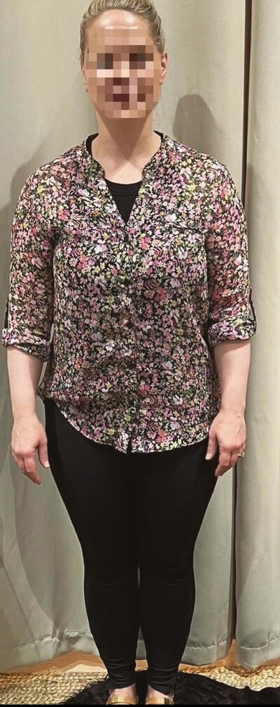 Before Front
