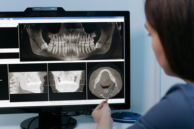 Prosthodontist explaining an X-ray to a patient, discussing full mouth rehabilitation options at Peak Prosthodontics in Lethbridge, Alberta.