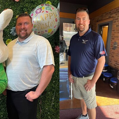 Before and afters of semaglutide results in ohio