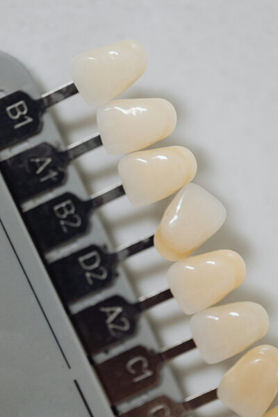 Different teeth whitening shades at Desert Hills Dental.