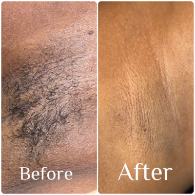 Before and after waxing results from Jazzy's Glam Bar in Tampa, FL, showing smooth and flawless skin.
