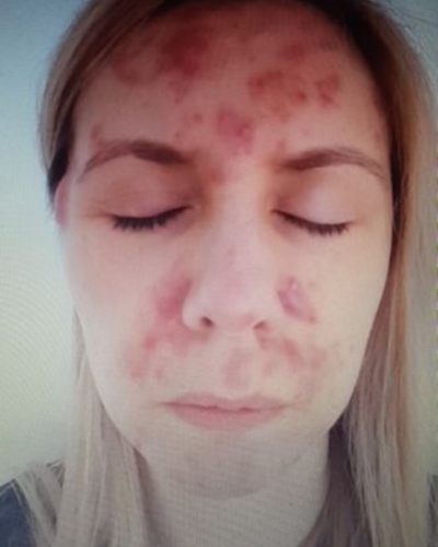 Karen-More-Wellness-BEFORE