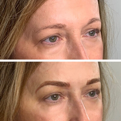 Filled in and luscious microblading eyebrow results from Refresh Aesthetics