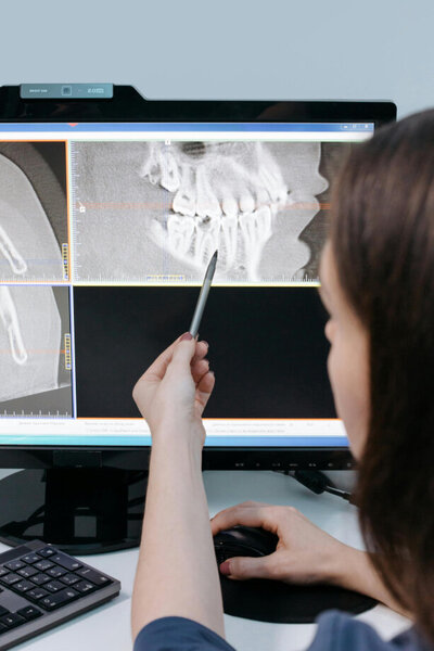 A dentist looking at an x-ray to look for any breaks, chips, or cracks for any dental emergencies.