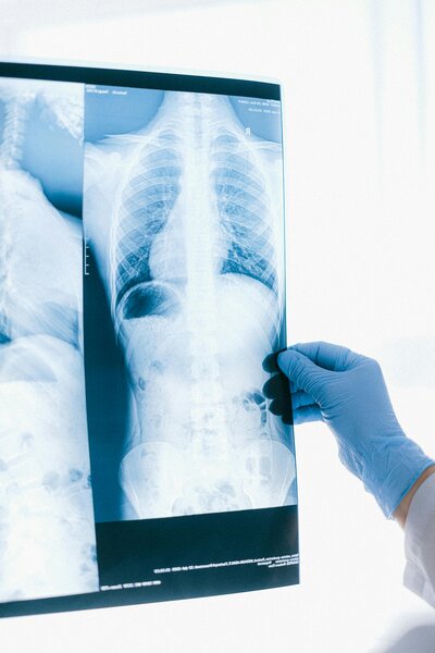 surgeon holding x ray of abdomen