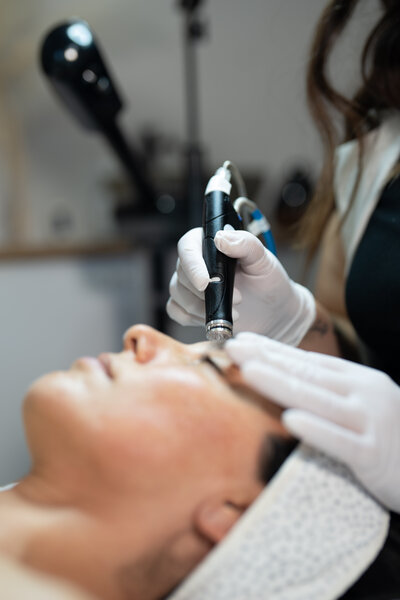 advanced microneedling services in Tucson
