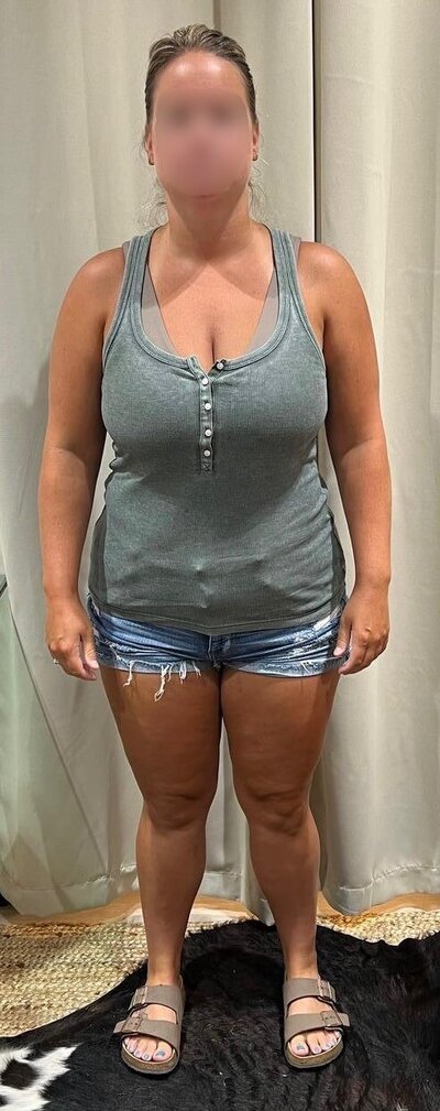 Before Front
