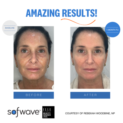 Set-36-Full-Face