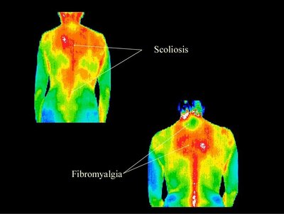 Thermography 3-min