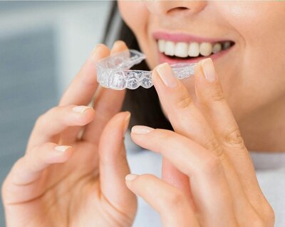 Patient fitting custom clear aligners to ensure proper fit and comfort during treatment at Peak Prosthodontics.